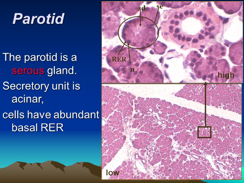 Parotid high low low se n RER sd The parotid is a  serous